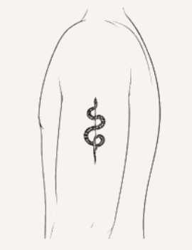 Upper arm